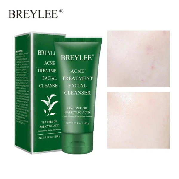 Breylee Acne Treatment Facial Cleanser-100 ml